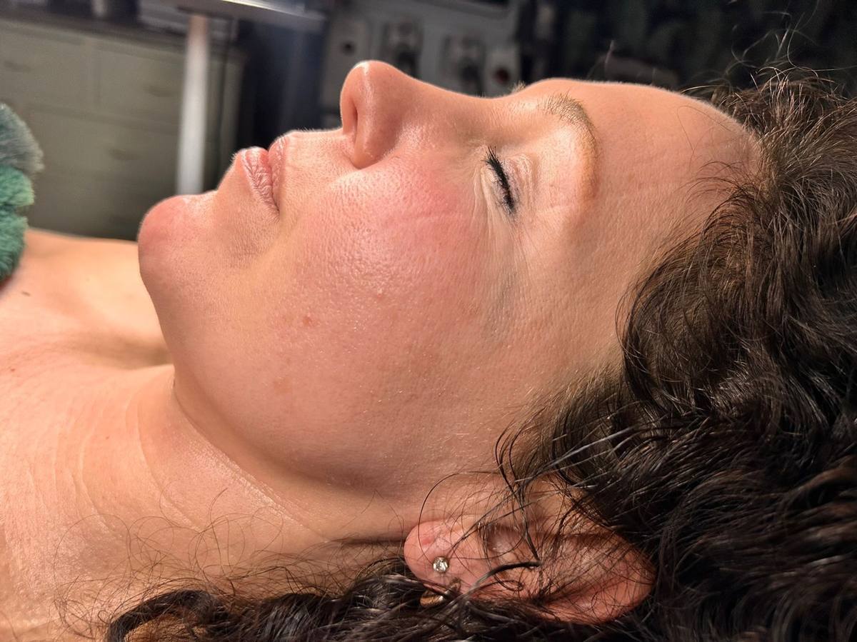 Facial treatment