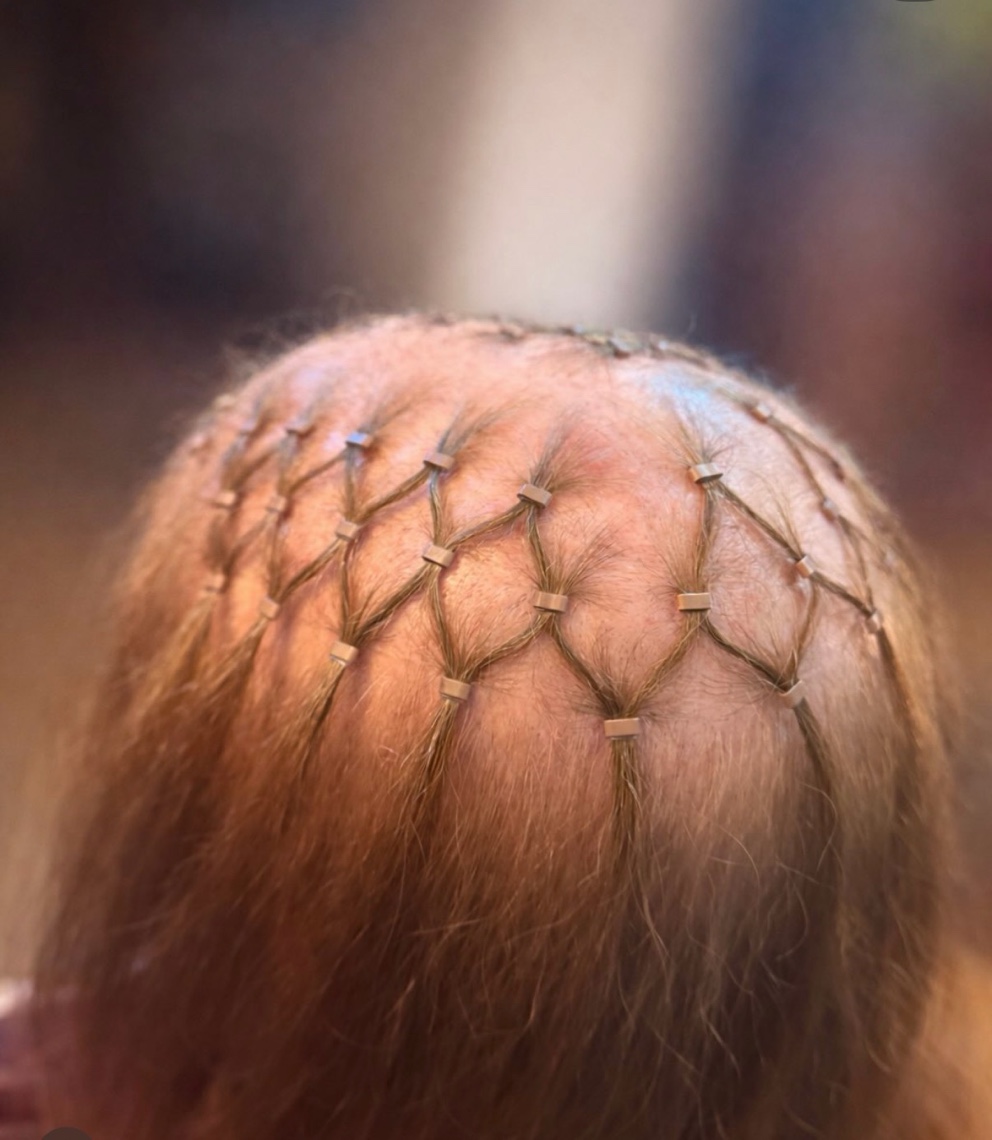 Mesh integration fitting