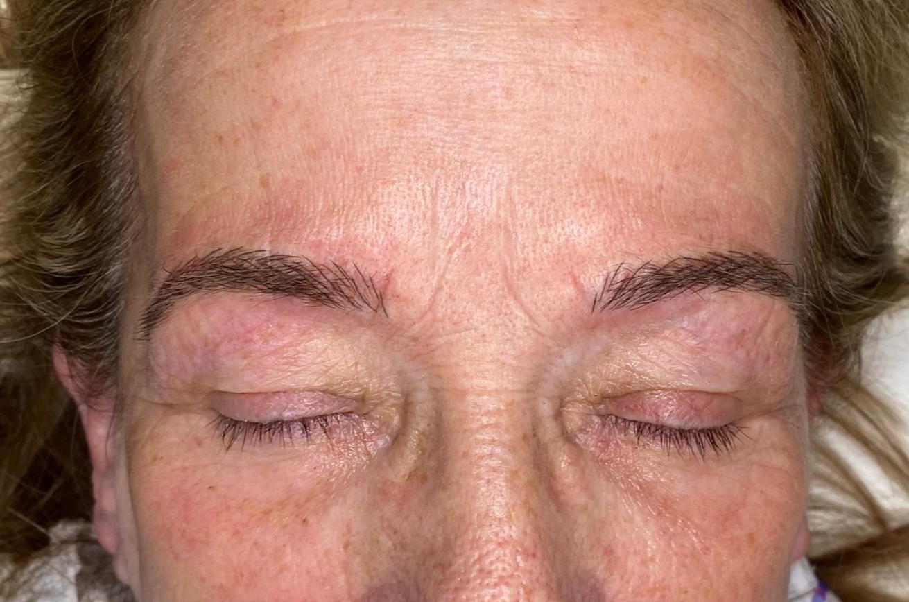 Microblading